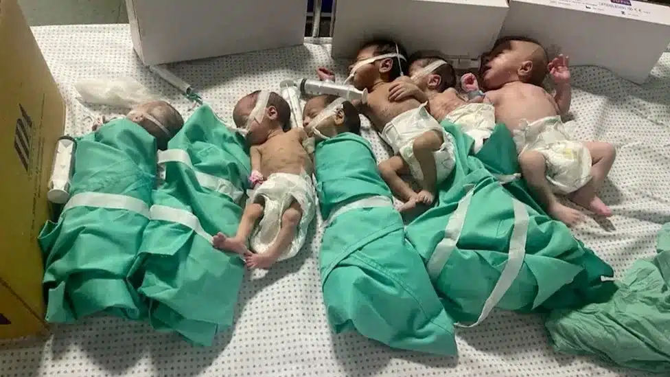 Image issued by medical staff of Al-Shifa Hospital Source: Reuters